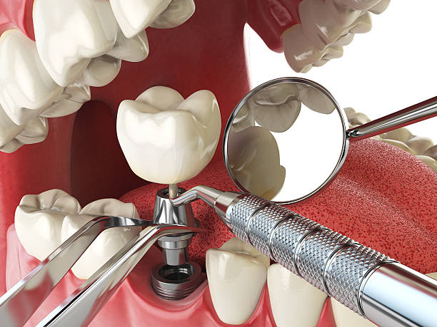 Best Emergency Dental Care for Abscessed Tooth in Beebe, AR